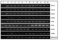 Isolation Of Peripheral Blood Mononuclear Cells And The Expression Of Toll-Like Receptors In Betong Chickens