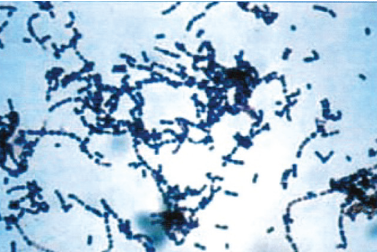 โรคหูดับ