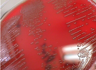 โรคหูดับ